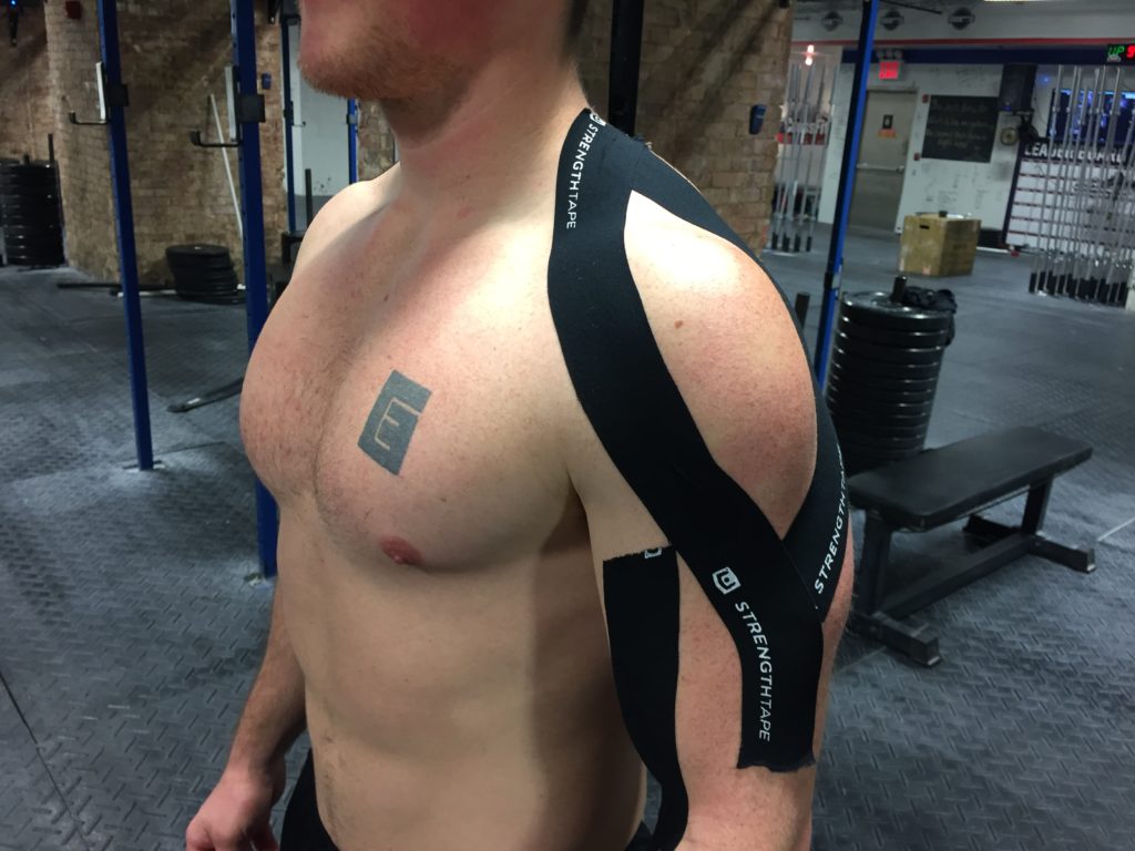 StrengthTape Kinesiology Tape Application