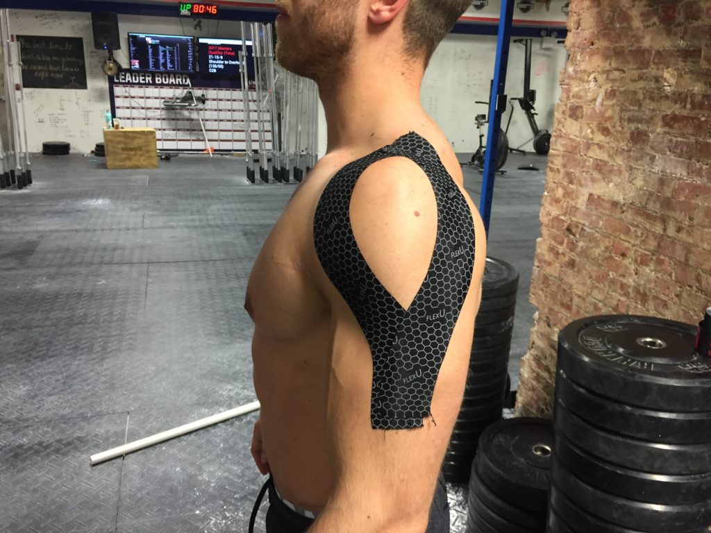 FlexU Supreme Kinesiology Tape Application