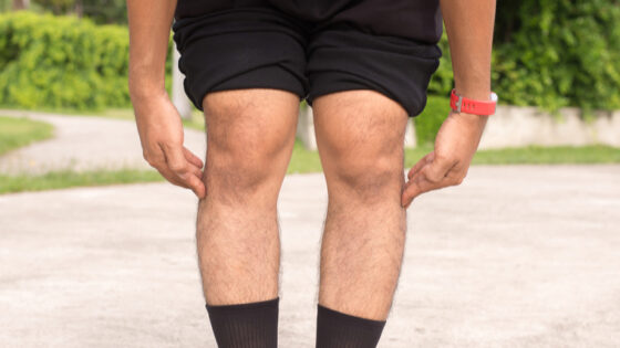 Understanding Knee Valgus — A Problem to Be Fixed, or a Natural Part of ...