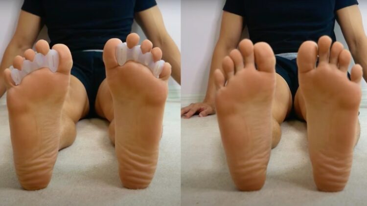 A side-by-side photo of feet with the toe spacers and feet without.