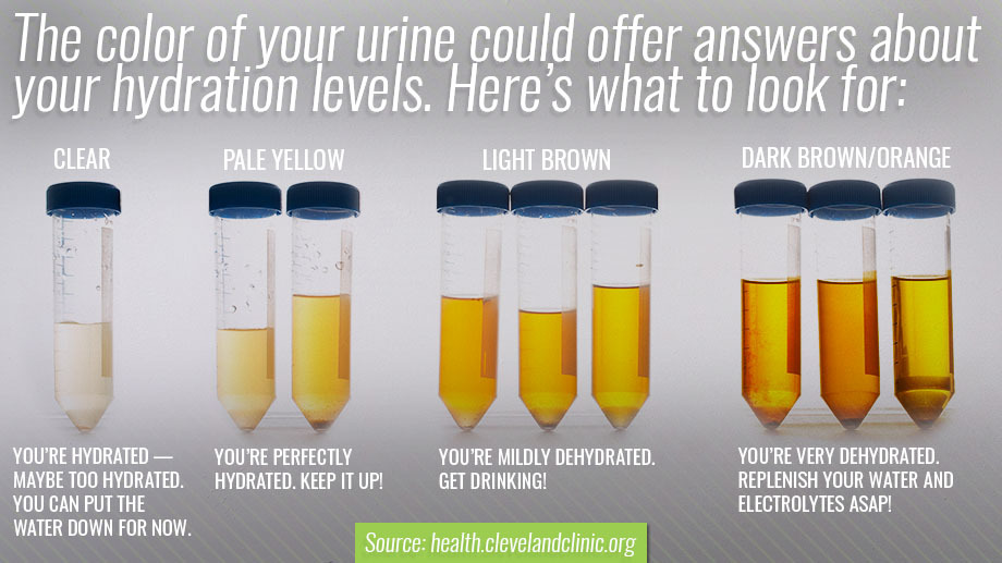 Urine color and hydration graphic. 