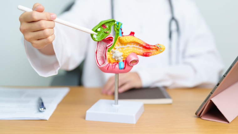 A doctor with human pancreatitis anatomy model with pancreas, gallbladder, bile duct, duodenum, small intestine etc.