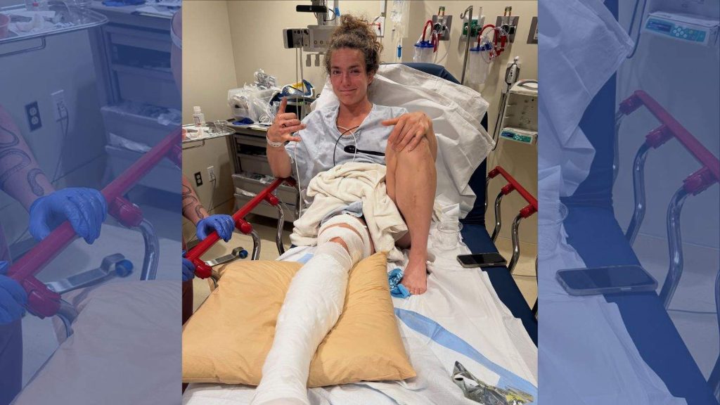 Alex Gazan’s CrossFit Games Season in Jeopardy After Car Accident Leaves Her With Fractured Fibula